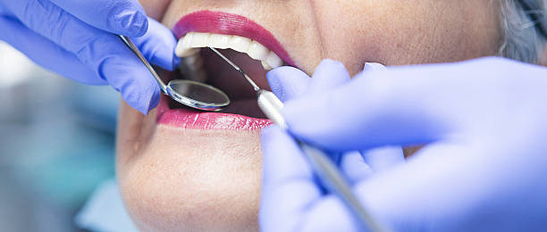 Best Emergency Broken Tooth Repair in Hidalgo, TX